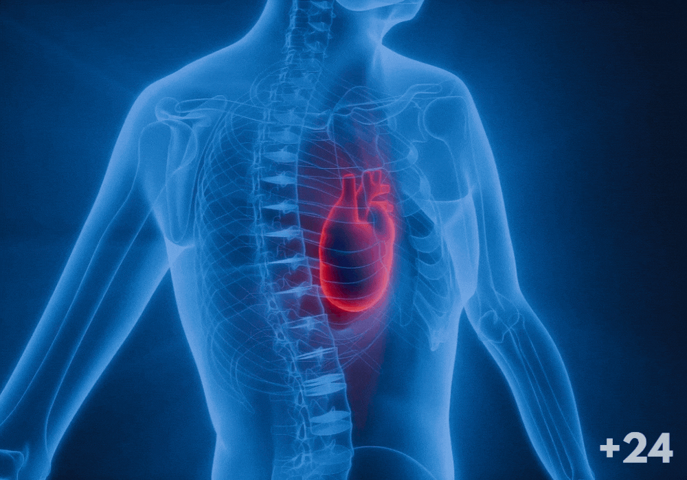 Cardiovascular
