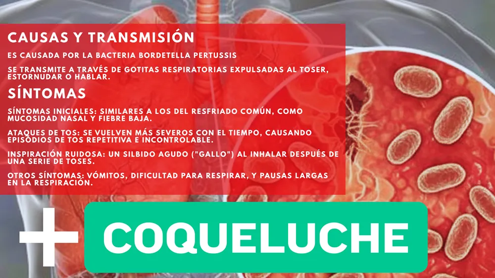 Coqueluche