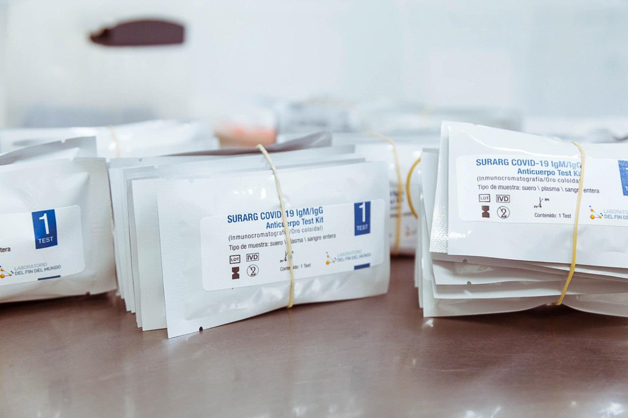 test anticuerpos coronavirus