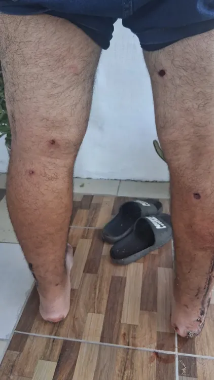 SALDO DE LA REPRESIÓN, HERIDOS Y DETENIDOS3