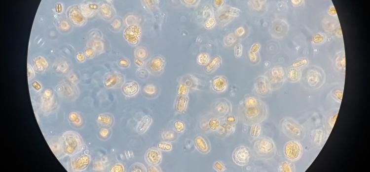 Una de las especies de fitoplancton de la Antartida -diatomeas centricas-